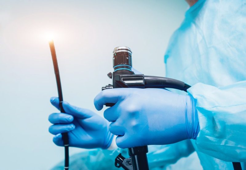 Endoscopía Digestiva